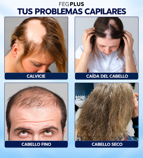FEG Plus™ Hair Growth Spray | Tratamiento Anticaída y Estimulador Folicular Avanzado (50ml)